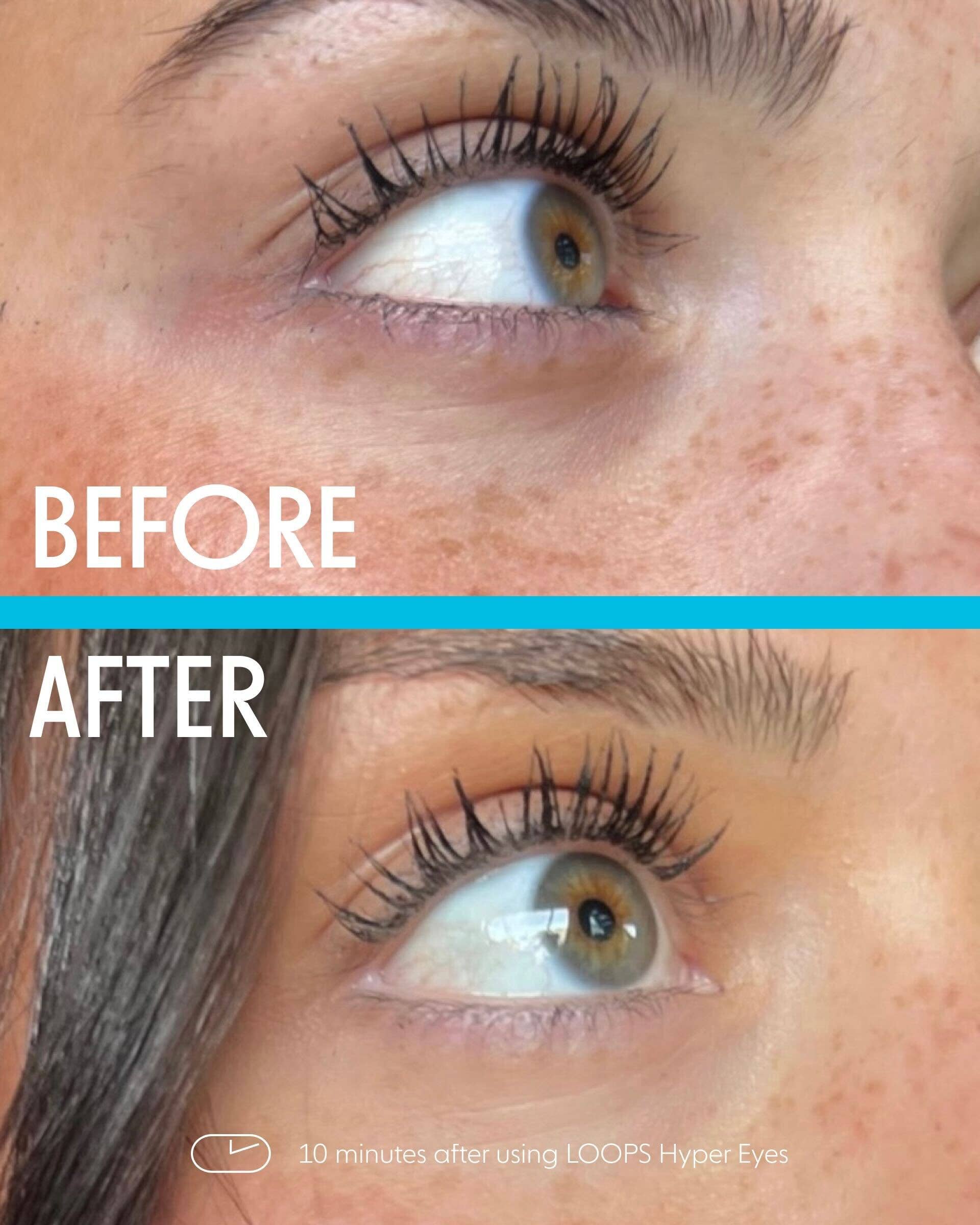 Hyper Eyes Single Eye Mask